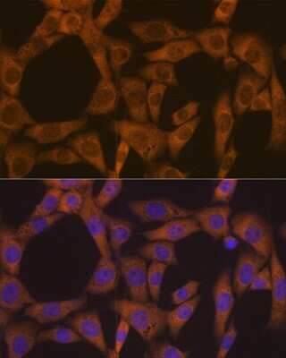Immunocytochemistry/ Immunofluorescence: CAD Antibody (0O8D6) [NBP3-16650]