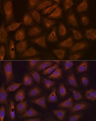 Immunocytochemistry/ Immunofluorescence: CAD Antibody (0O8D6) [NBP3-16650]
