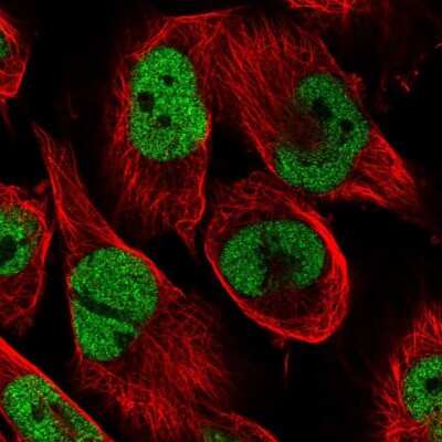 Immunocytochemistry/ Immunofluorescence: CAD Antibody [NBP2-58494]