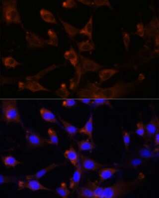Immunocytochemistry/ Immunofluorescence: CAD Antibody - BSA Free [NBP2-92924]