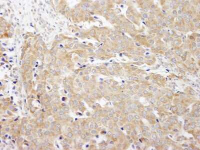 Immunohistochemistry: CAD Antibody [NB100-61613]