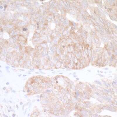 Immunohistochemistry-Paraffin: CAD Antibody [NB100-61614]