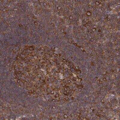 Immunohistochemistry-Paraffin: CAD Antibody [NBP2-56453]