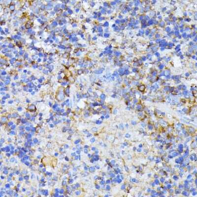 Immunohistochemistry-Paraffin: CAD Antibody - BSA Free [NBP2-92924]