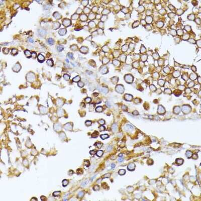 Immunohistochemistry-Paraffin: CAD Antibody - BSA Free [NBP2-92924]