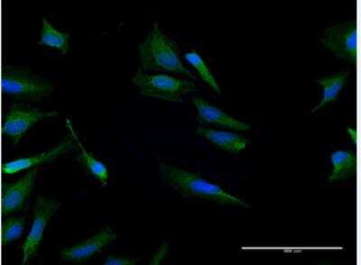 Immunocytochemistry/ Immunofluorescence: CALCB Antibody [H00000797-B02P-50ug]