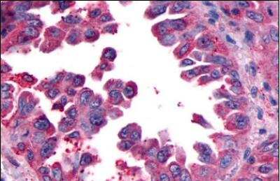 Immunohistochemistry-Paraffin: CRLR Antibody - BSA Free [NLS6755]