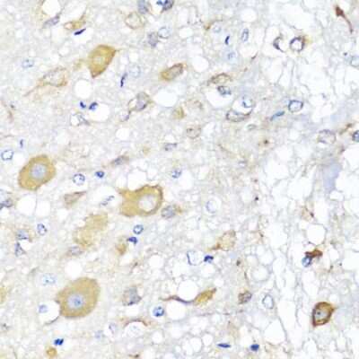 Immunohistochemistry-Paraffin: CALHM1 Antibody - BSA Free [NBP2-92818]