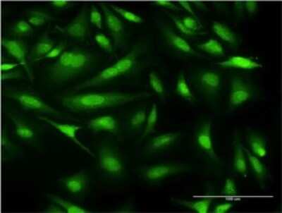 Immunocytochemistry/ Immunofluorescence: CALML3 Antibody (2A11) [H00000810-M04]