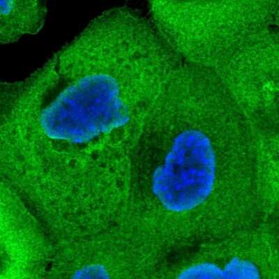Immunocytochemistry/ Immunofluorescence: CALML5 Antibody [NBP1-84437]