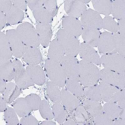 Immunohistochemistry-Paraffin: CALML5 Antibody [NBP1-84437]