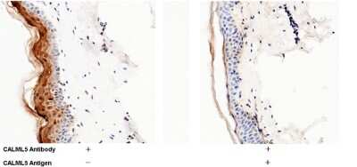 Immunohistochemistry-Paraffin: CALML5 Antibody [NBP2-99872]