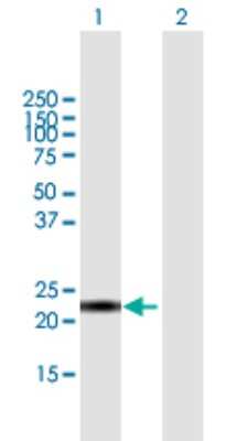 Western Blot: CALML6 Antibody [H00163688-B01P]
