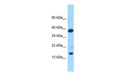 Western Blot: CALML6 Antibody [NBP2-86594]