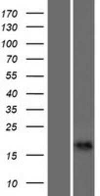 Western Blot: CALML6 Overexpression Lysate [NBP2-05641]