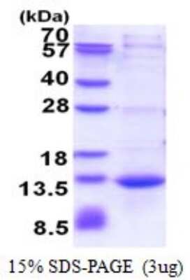 SDS-PAGE: Recombinant Human CAMK2N1 His Protein [NBP2-51581]