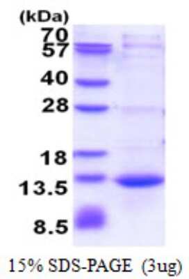 SDS-PAGE: Recombinant Human CAMK2N1 His Protein [NBP2-51581]