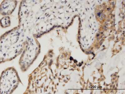 Immunohistochemistry-Paraffin: CAMKID Antibody (3H8) [H00057118-M10]