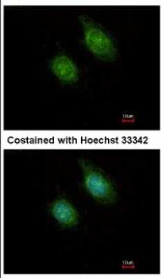 Immunocytochemistry/ Immunofluorescence: CAMKID Antibody [NBP1-31478]