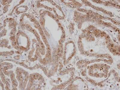 Immunohistochemistry-Paraffin: CAMKID Antibody [NBP1-31478]