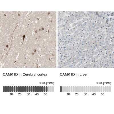 Immunohistochemistry-Paraffin: CAMKID Antibody [NBP1-85589]