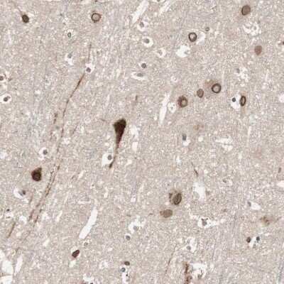 Immunohistochemistry-Paraffin: CAMKID Antibody [NBP1-85589]