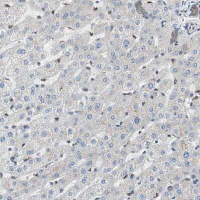 Immunohistochemistry-Paraffin: CAMKID Antibody [NBP1-85589]