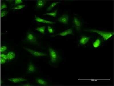 Immunocytochemistry/ Immunofluorescence: CAMLG Antibody (3F12) [H00000819-M02]