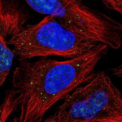 Immunocytochemistry/ Immunofluorescence: CAMLG Antibody [NBP2-33661]