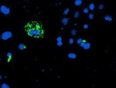 Immunocytochemistry/ Immunofluorescence: CAMLG Antibody (OTI1A3) - Azide and BSA Free [NBP2-70331]