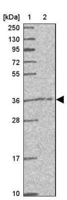 Western Blot: CAMLG Antibody [NBP2-33661]