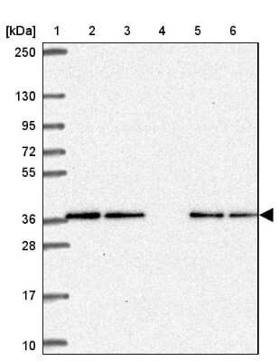 Western Blot: CAMLG Antibody [NBP2-33789]