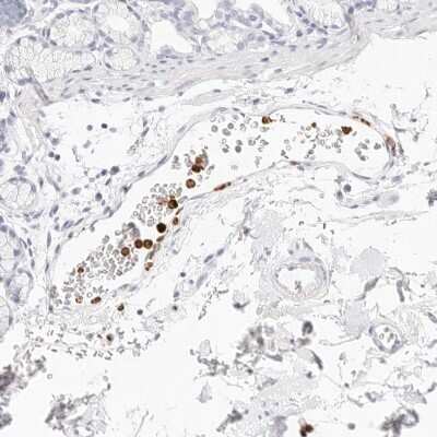 Immunohistochemistry-Paraffin: CAMP/Cathelicidin Antibody [NBP1-88203]
