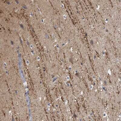 Immunohistochemistry-Paraffin: CAMSAP1 Antibody [NBP1-84193]