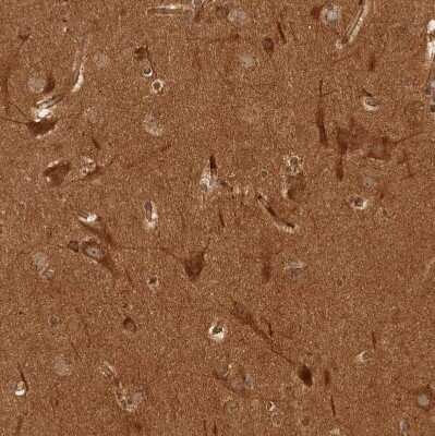 Immunohistochemistry-Paraffin: CAMSAP1L1 Antibody [NBP1-82934]