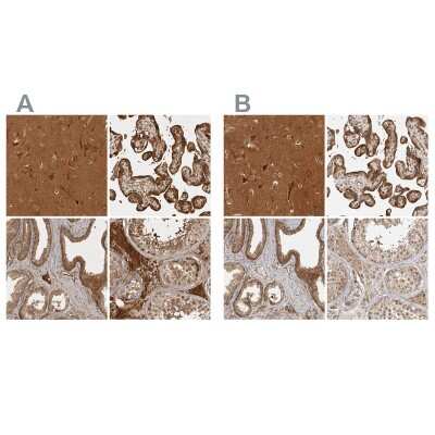 Immunohistochemistry-Paraffin: CAMSAP1L1 Antibody [NBP1-82934]