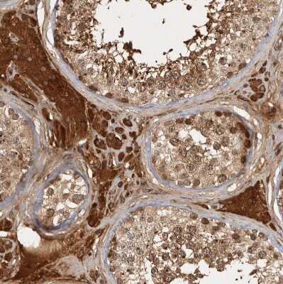 Immunohistochemistry-Paraffin: CAMSAP1L1 Antibody [NBP1-82934]