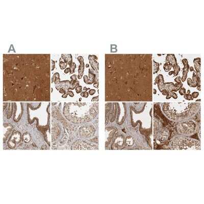 Immunohistochemistry-Paraffin: CAMSAP1L1 Antibody [NBP1-82935]