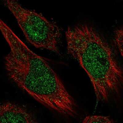 Immunocytochemistry/ Immunofluorescence: CAMTA2 Antibody [NBP2-56136]