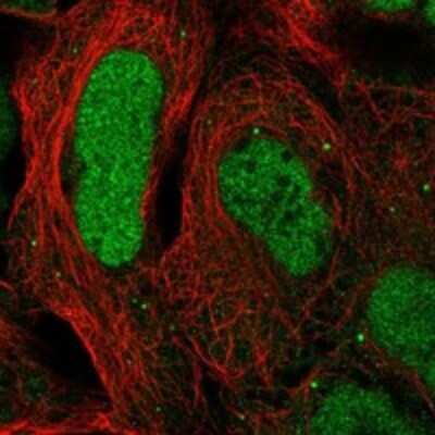 Immunocytochemistry/ Immunofluorescence: CAMTA2 Antibody [NBP3-17574]