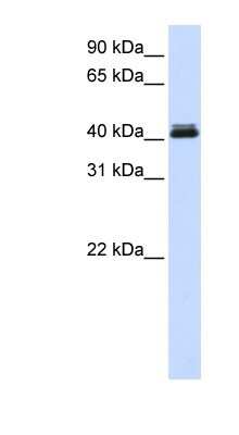 Western Blot: Calcium Activated Nucleotidase 1/CANT1 Antibody [NBP1-58875]
