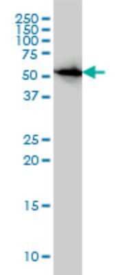 Western Blot: CAP1 Antibody (4A2) [H00010487-M01]