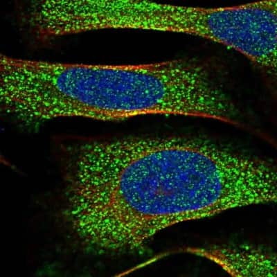 Immunocytochemistry/ Immunofluorescence: CAP1 Antibody [NBP1-86644]