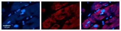 Immunohistochemistry: CAP1 Antibody [NBP1-58320]