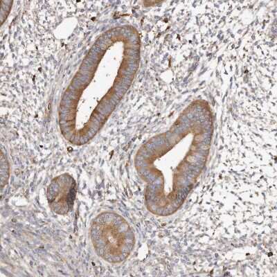 Immunohistochemistry-Paraffin: CAP1 Antibody [NBP1-86644]
