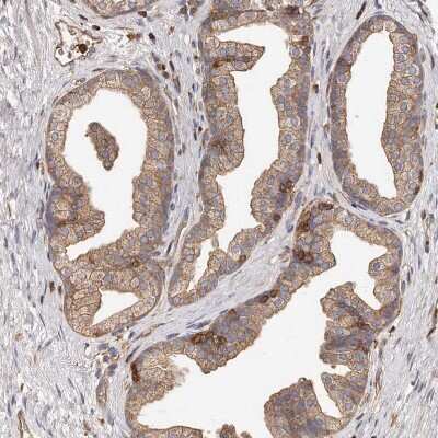 Immunohistochemistry-Paraffin: CAP1 Antibody [NBP1-86644]