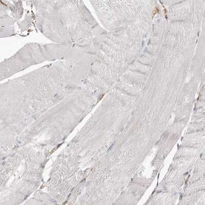 Immunohistochemistry-Paraffin: CAP1 Antibody [NBP1-86644]
