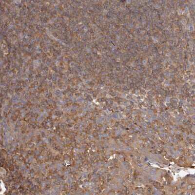 Immunohistochemistry-Paraffin: CAP1 Antibody [NBP1-86644]
