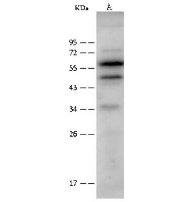 Western Blot: CAP1 Antibody [NBP2-99569]
