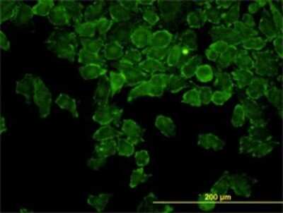 Immunocytochemistry/ Immunofluorescence: CAP2 Antibody (3G9-1A5) [H00010486-M01]